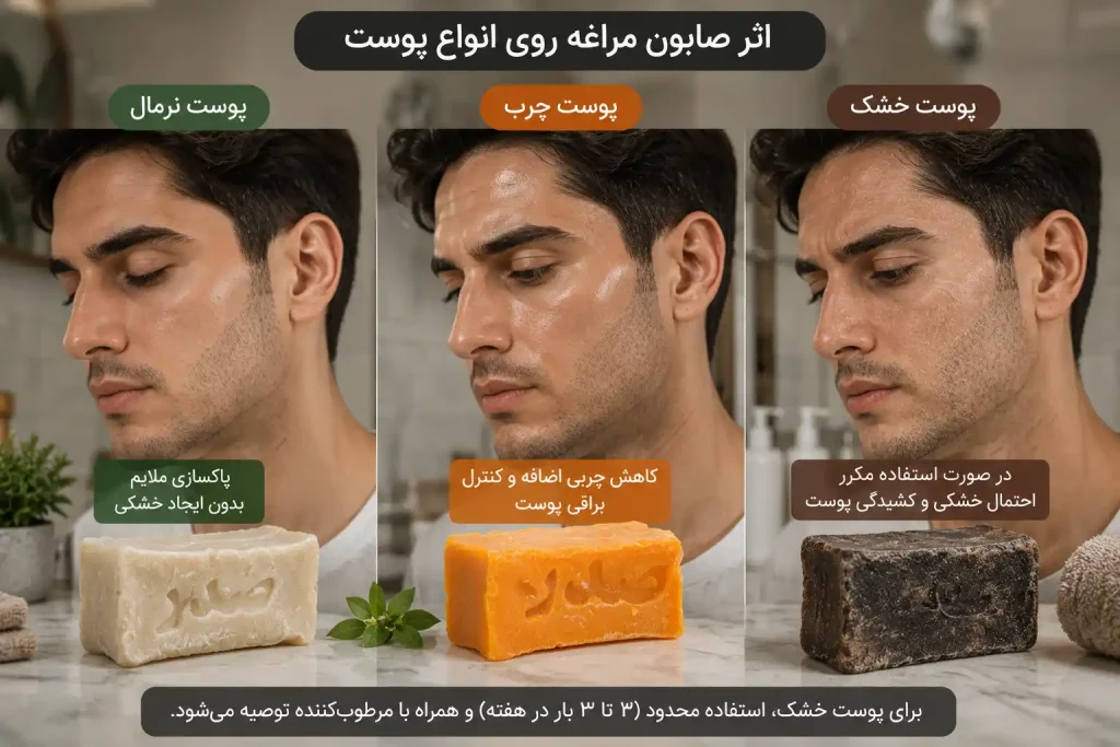 تاثیر صابون مراغه روی انواع پوست