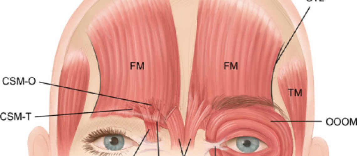massage+for+headache